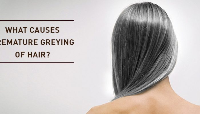 What Causes Premature Greying of Hair?